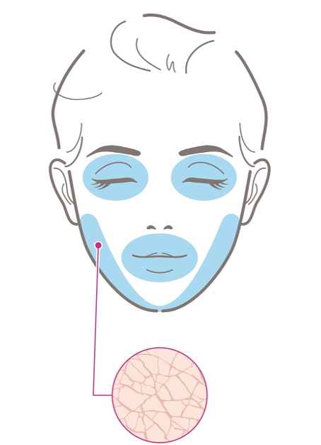 zonas de piel seca en la cara