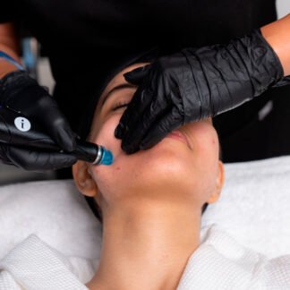HYDRAFACIAL SENSITIVE SKIN