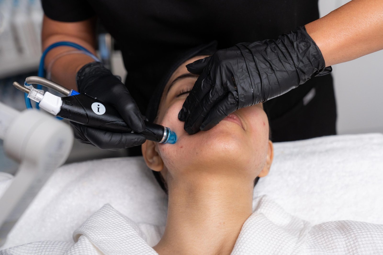 Pore Detox (Anti-Acné)